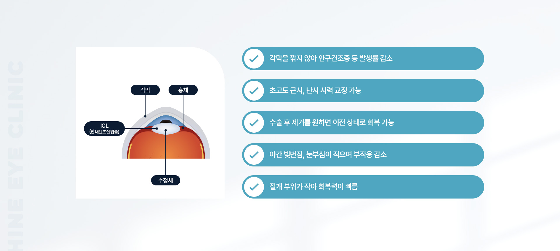 안내렌즈삽입 03