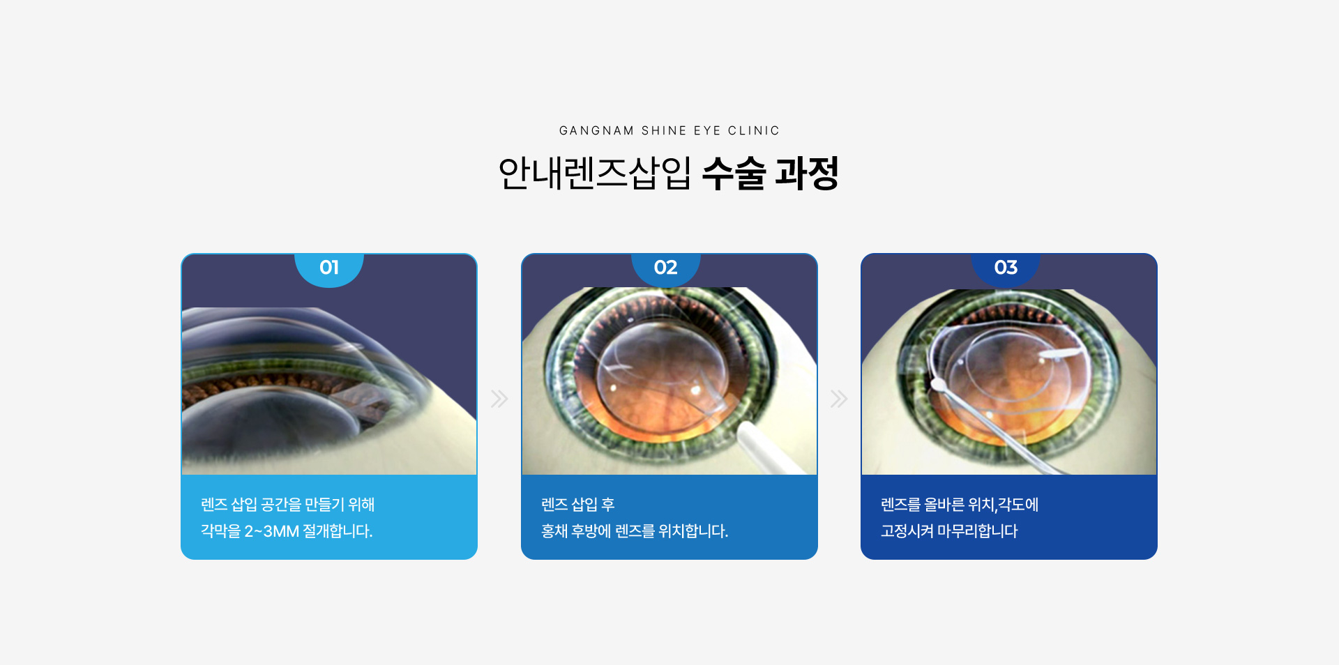 안내렌즈삽입 07