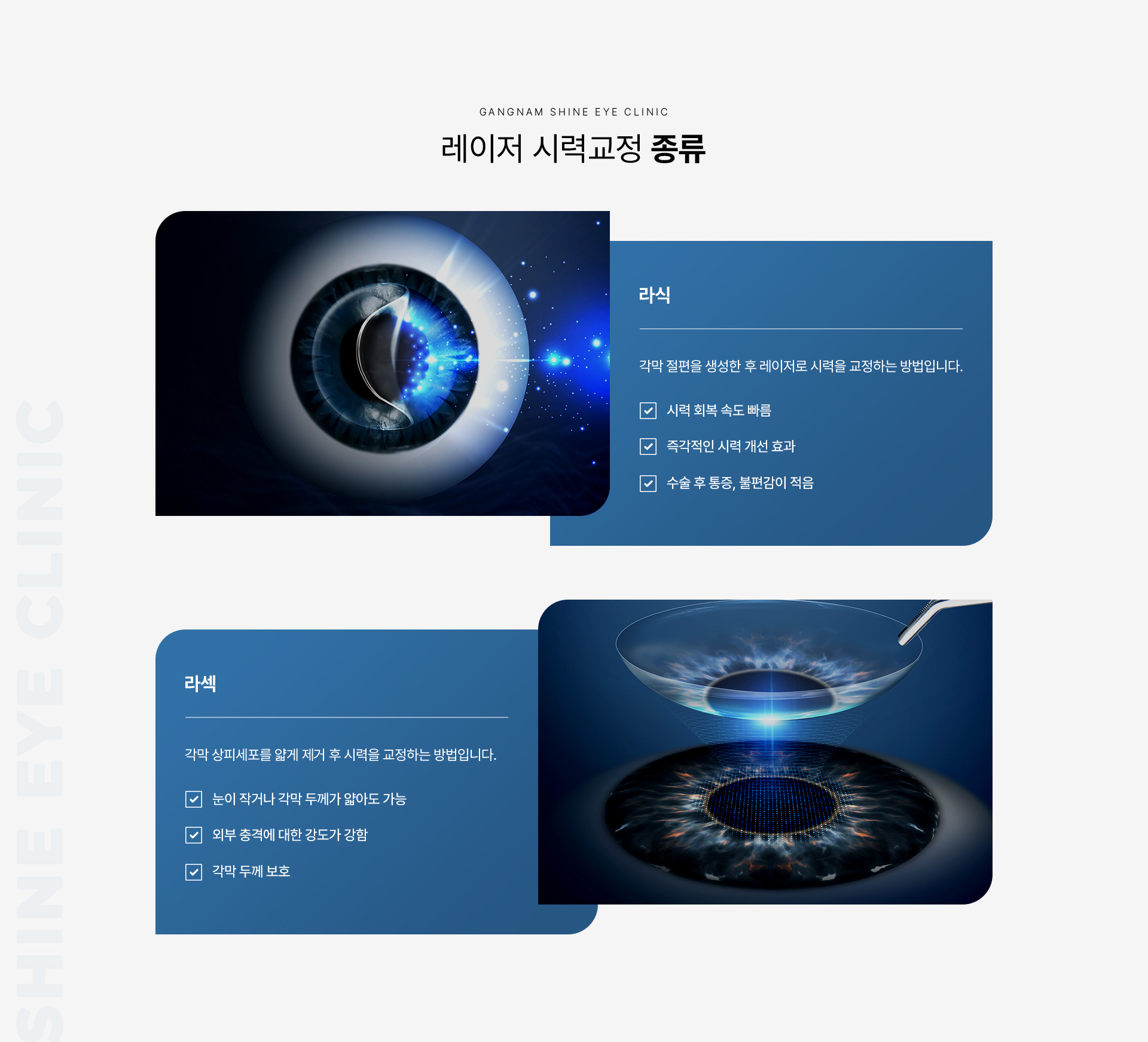 레이저 시력교정 03