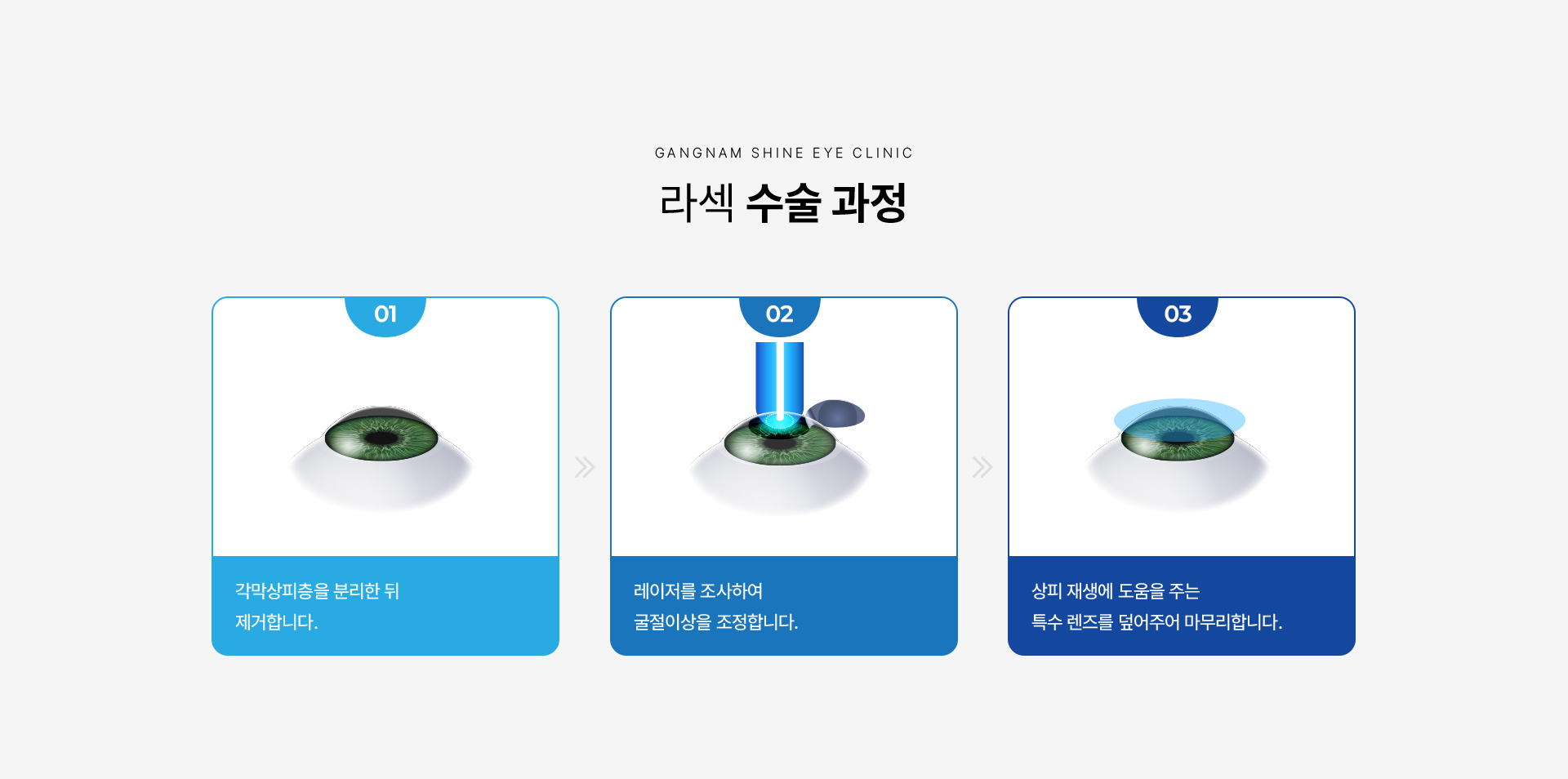 레이저 시력교정 07