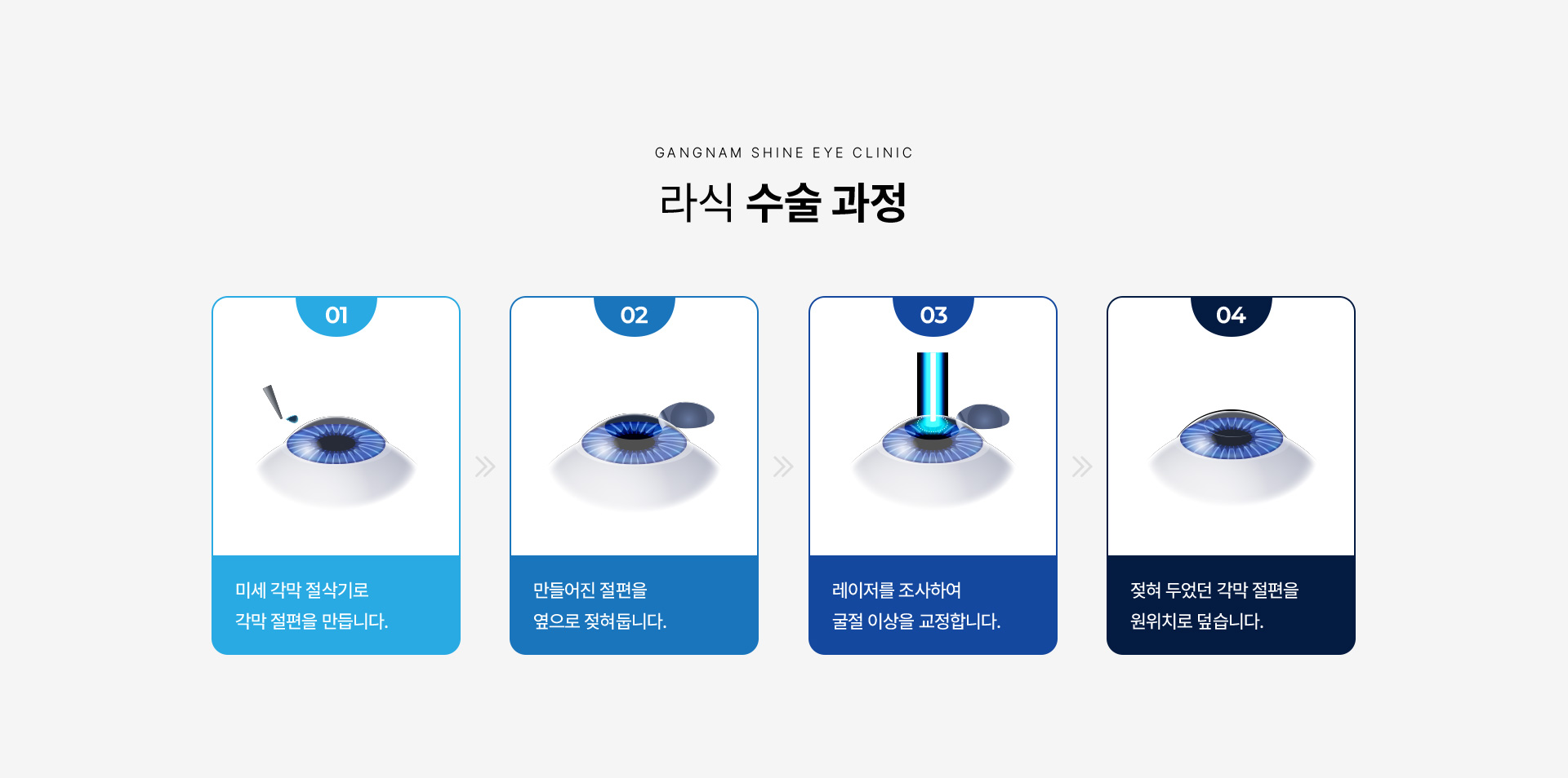 레이저 시력교정 09