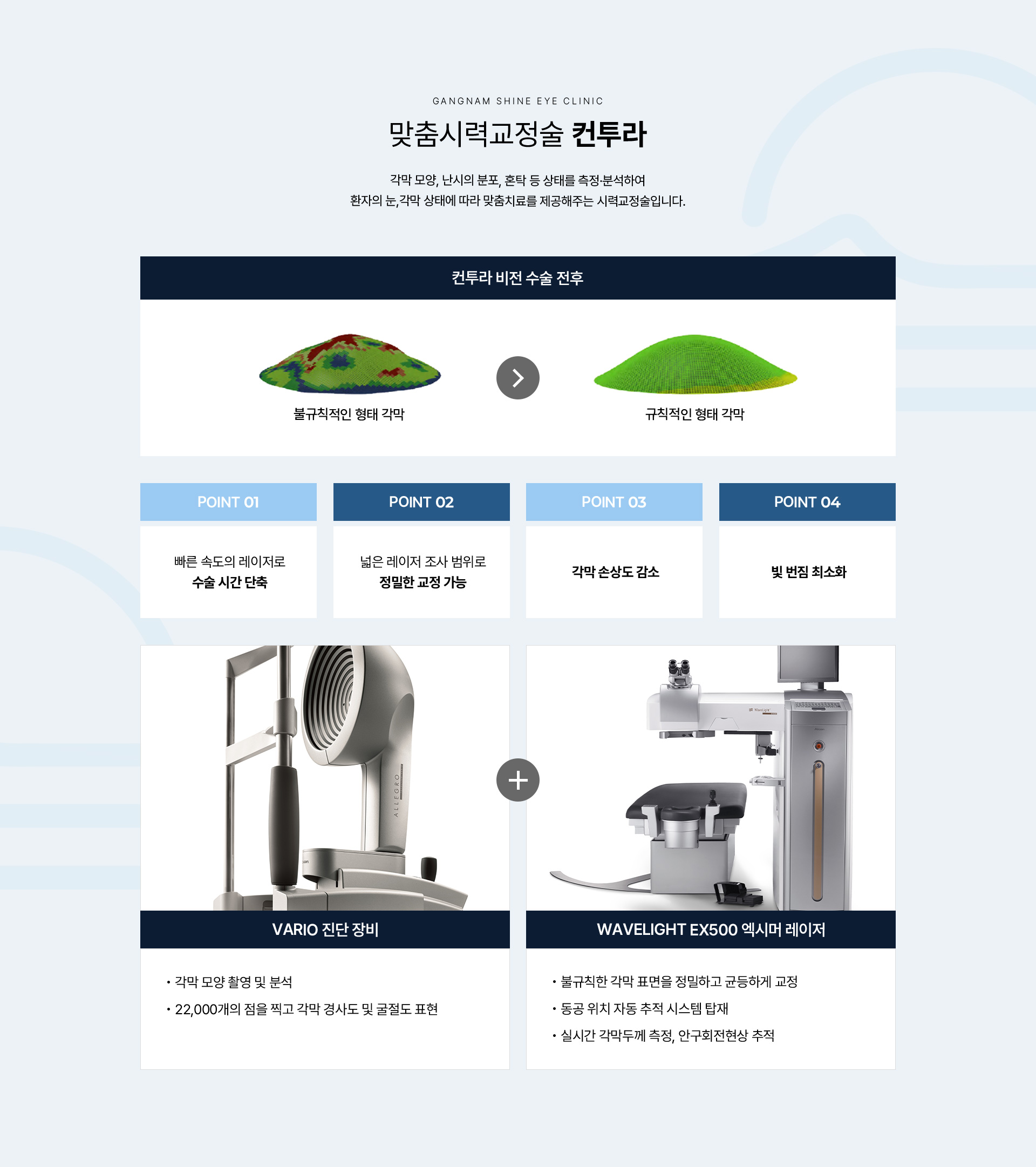 레이저 시력교정 10