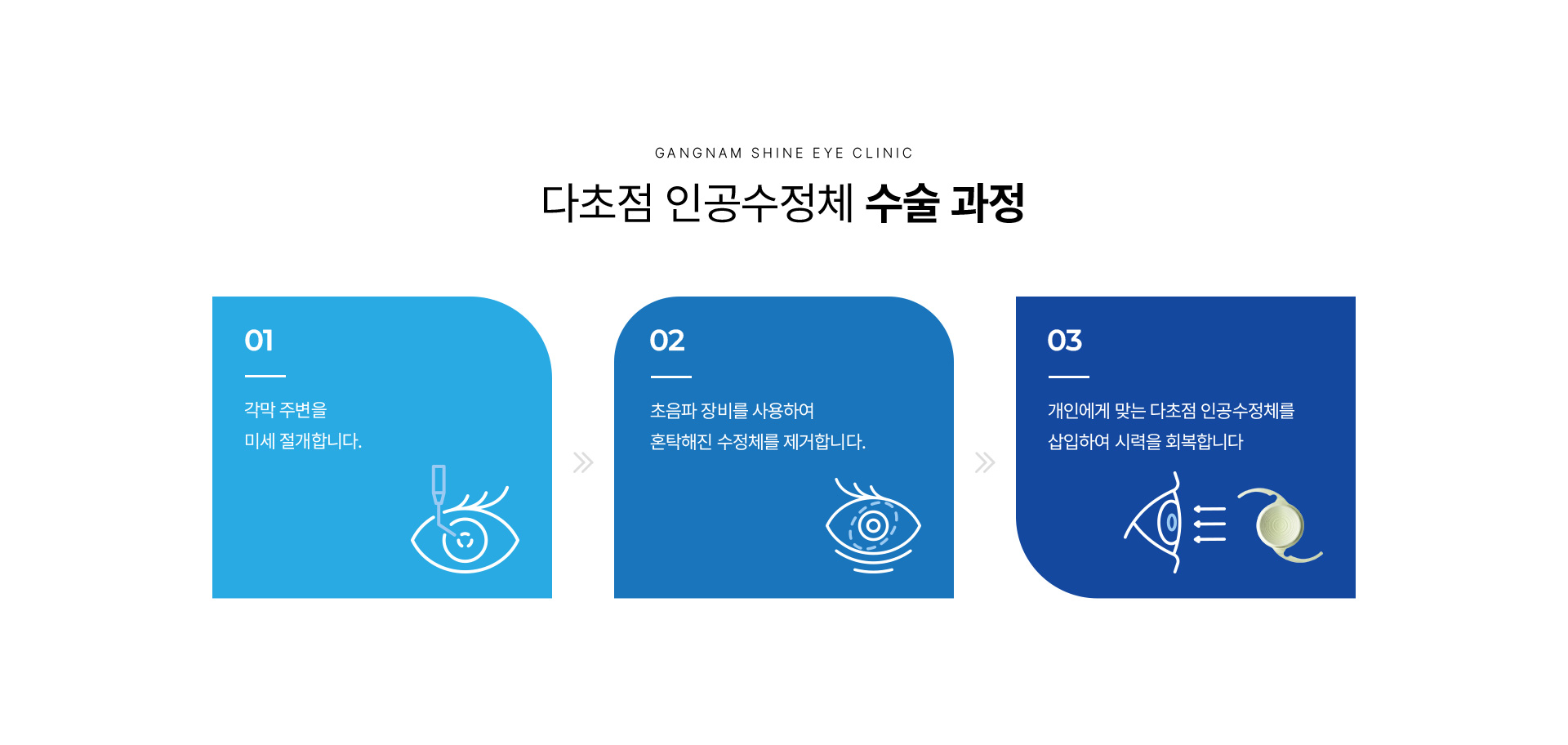 다초점 인공수정체 04