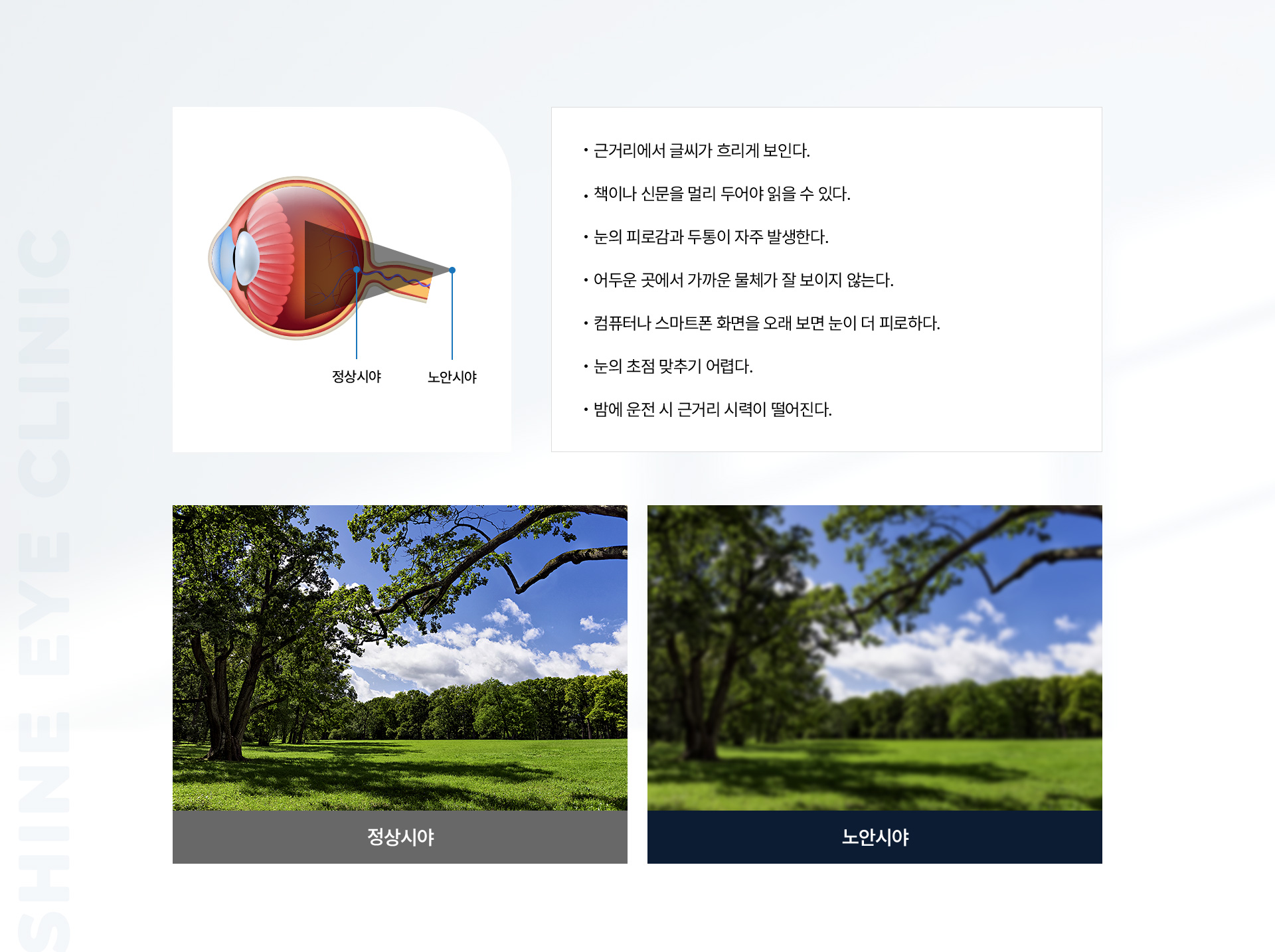 노안과 백내장 03