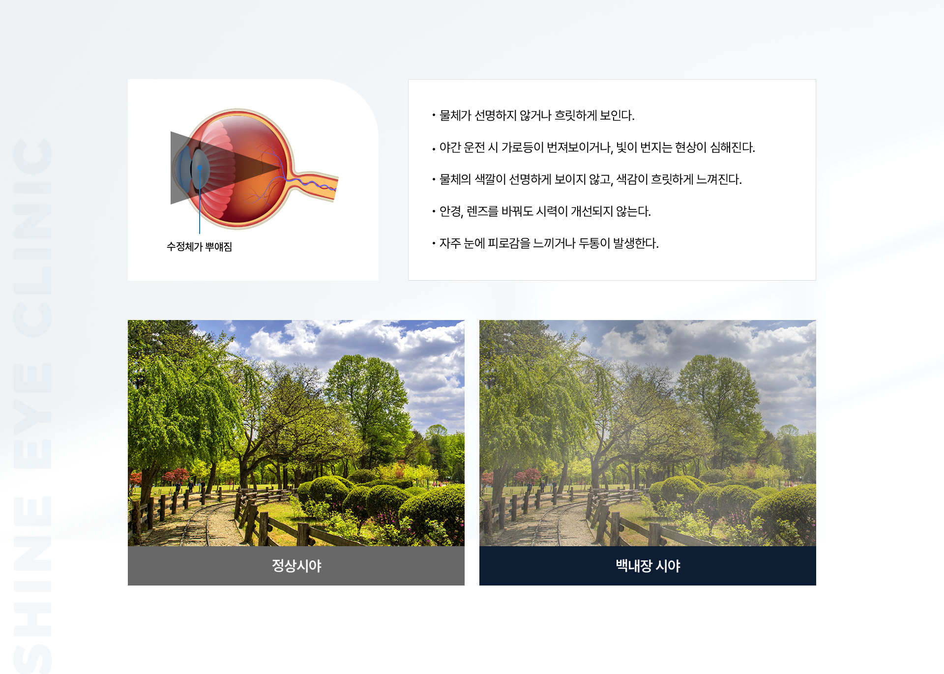 노안과 백내장 05