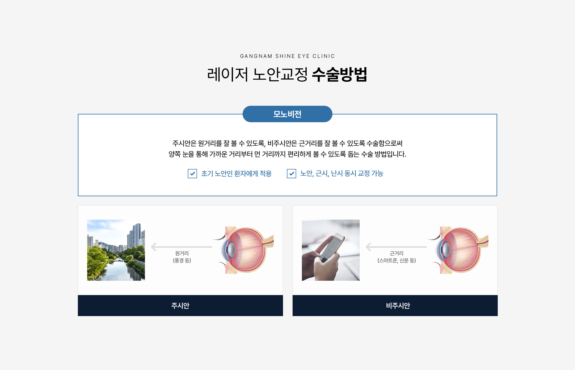 레이저 노안교정 05